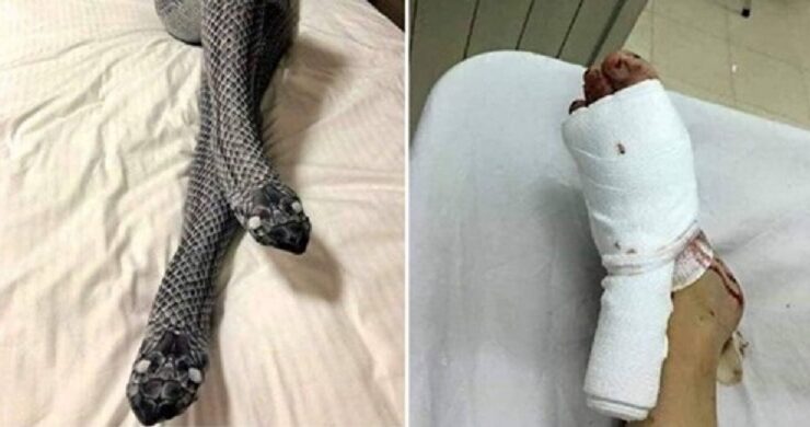 স্বামীকে সারপ্রাইজ দেওয়ার জন্য সাপের পোশাক পরলেন স্ত্রী, উল্টো পা ভে’ঙ্গে দিল স্বামী