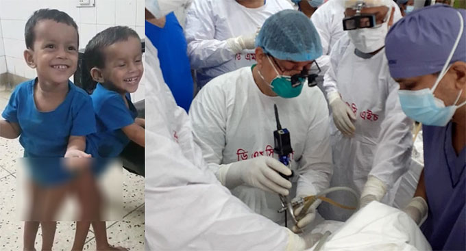 ১২ ঘণ্টার সফল অস্ত্রোপচার: আলাদা হলো লাবিবা-লামিসা