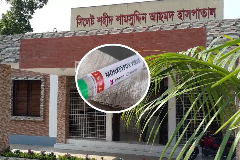 মাংকিপক্স: সিলেটে প্রস্তুত করা হলো হাসপাতাল